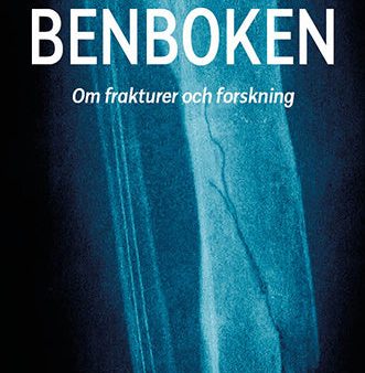 Benboken : om frakturer och forskning Discount